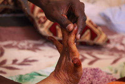 Developing Palliative Care in Mauritania